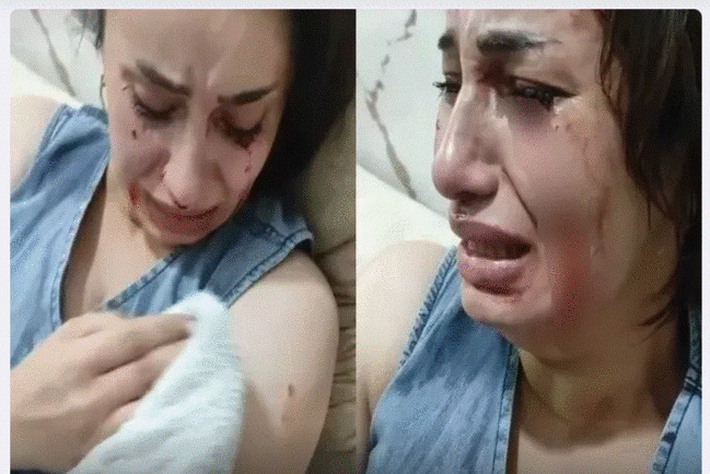 "Onu o qədər vurmuşam, hələ sağdır?" - Lazeroloqu bıçaqlayan nələr deyib?