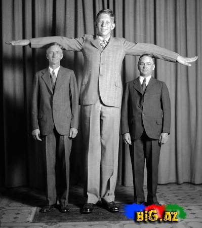 Dünya Tibb Tarixinin Ən Uzun Boylu Adamı