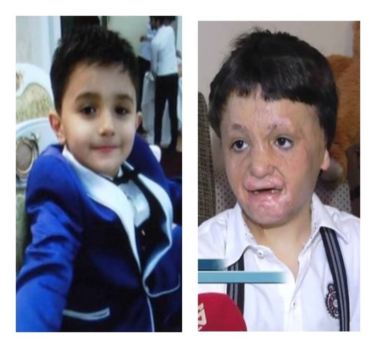 "Leyla Əliyeva məni xilas elədi..." - VİDEO