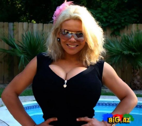 Dünyanın ən böyük döşlü qadını ölə bilər