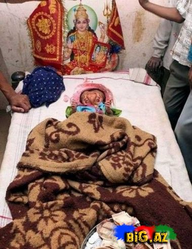 Hindistanda dörd gözlü və iki üzlü uşaq