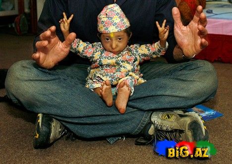 Dünyanın ən balaca boy adamı müəyyənləşdi