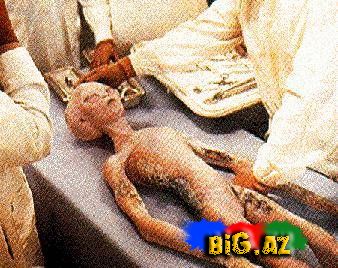 Dünyada olan xarici varlıq tipləri