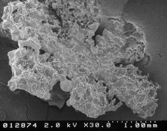 Qar dənələri mikroskop altında