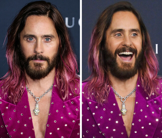 Təbəssüm etdikdə sanki başqa insana çevrilən 17 ULDUZ - FOTO