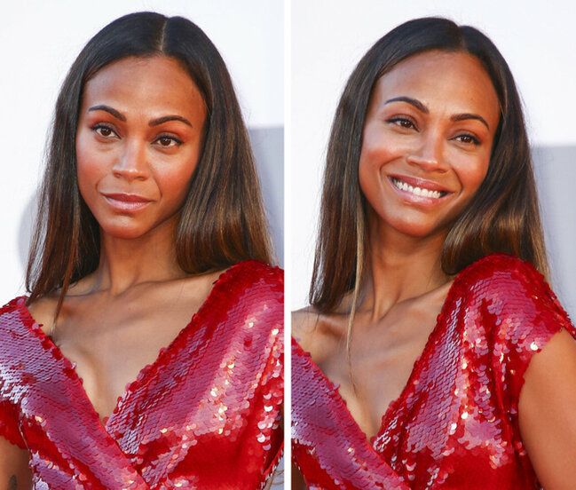 Təbəssüm etdikdə sanki başqa insana çevrilən 17 ULDUZ - FOTO