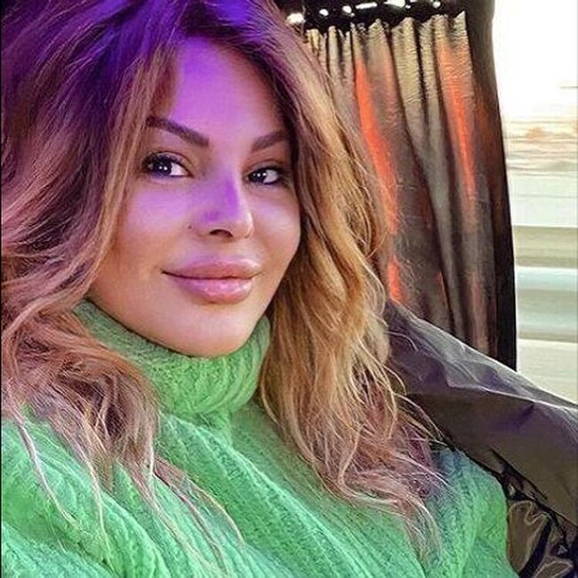 Aygün Kazımovanın DƏYİŞİMİ ŞOK ETDİ - FOTOLAR