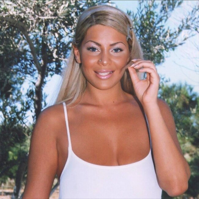 Aygün Kazımovanın DƏYİŞİMİ ŞOK ETDİ - FOTOLAR