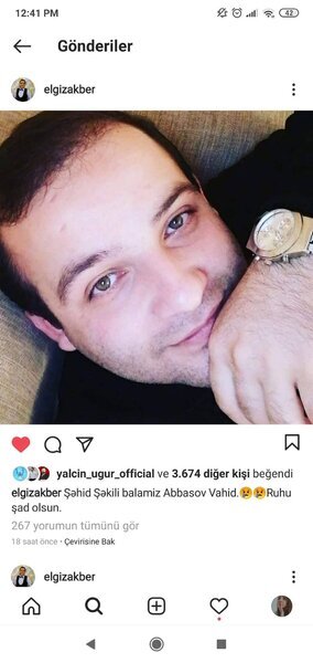 Koronavirusa yoluxan Elgizdən XƏBƏR VAR