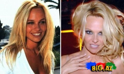 Dünya məşhurların əvvəl ki və indi ki olan foto şəkilləri (Foto)