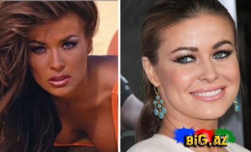 Dünya məşhurların əvvəl ki və indi ki olan foto şəkilləri (Foto)