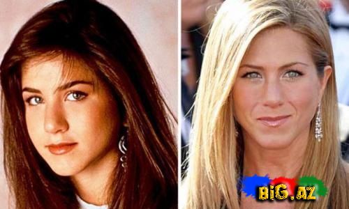 Dünya məşhurların əvvəl ki və indi ki olan foto şəkilləri (Foto)