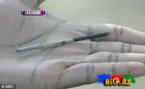 Tikinti silahından açılan mismar ürəyinə girdi (Foto)