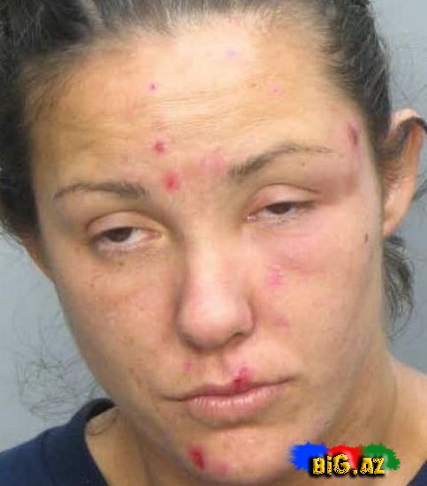 Amfetamin nədir? və onun nəticələri (Fotolar)