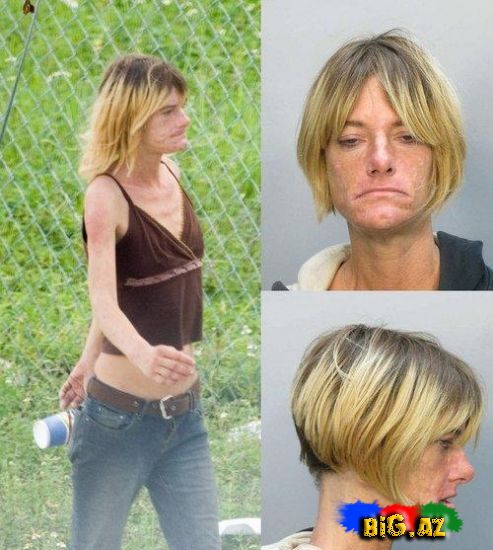 Amfetamin nədir? və onun nəticələri (Fotolar)