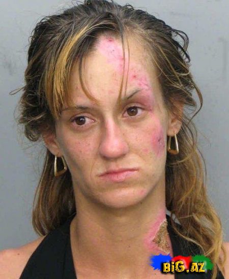 Amfetamin nədir? və onun nəticələri (Fotolar)