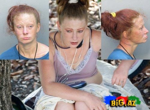 Amfetamin nədir? və onun nəticələri (Fotolar)