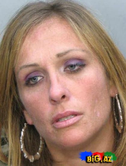 Amfetamin nədir? və onun nəticələri (Fotolar)