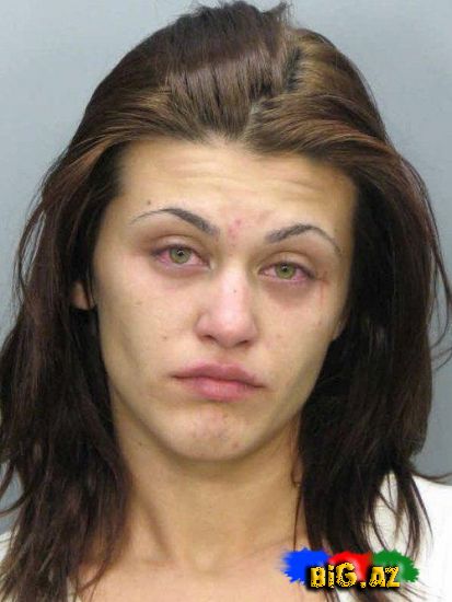 Amfetamin nədir? və onun nəticələri (Fotolar)