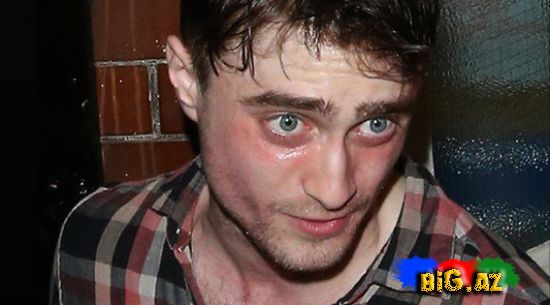 Harry Potteri narkotika bu hala saldı - Fotolar
