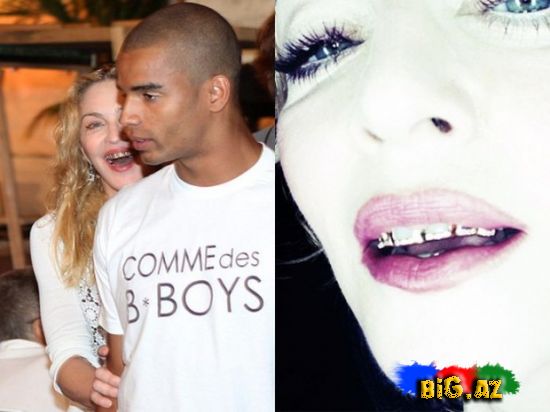 Madonna qızıl dişlərinə 24 brilyant taxdı -Fotolar