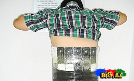 Bədənində 66 "iPhone" aşkarlandı