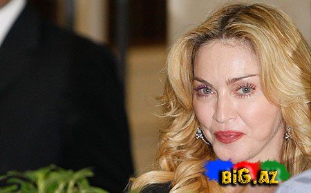 Dünya indi də Madonnanın brilliant dişlərindən danışır - Fotolar