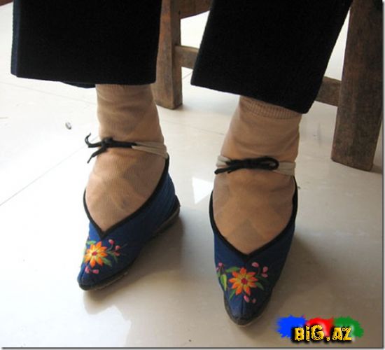 Aristokratiya ənənələri: Çində ayaqların deformasiyası Məlumat və FOTO