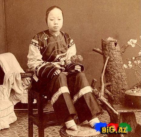 Aristokratiya ənənələri: Çində ayaqların deformasiyası Məlumat və FOTO