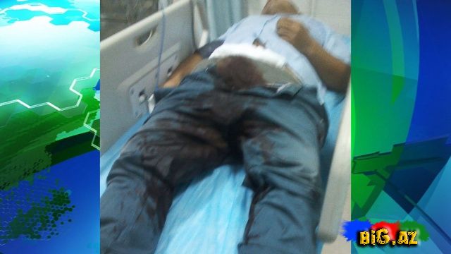 Özünə qız tapa bilməyən oğlan cinsi orqanını kəsdi