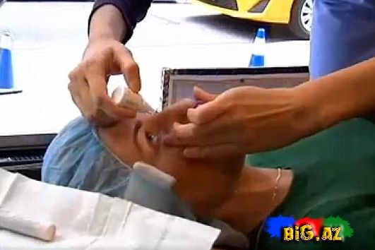 Göz bəbəyinə qızıl yerləşdirənlər - VİDEO