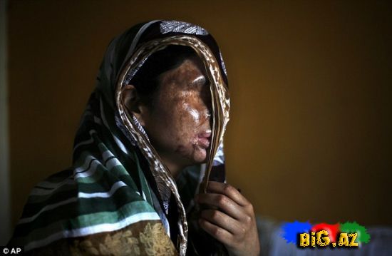 Hindistanda "kislota" qanunu qəbul edildi - FOTO