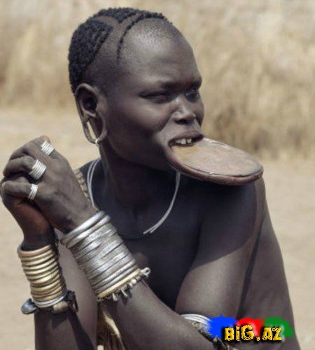 Dodaq böyütməyin iyrənc yolları - FOTO