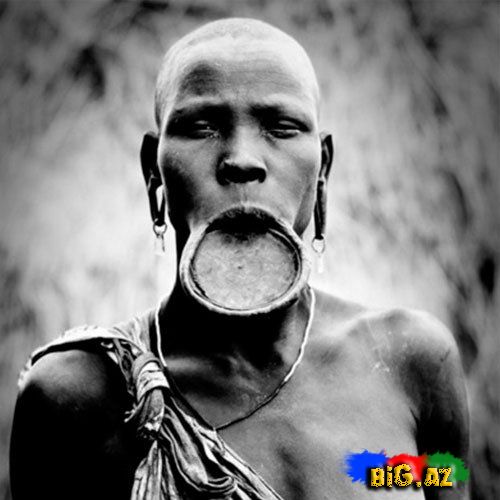 Dodaq böyütməyin iyrənc yolları - FOTO