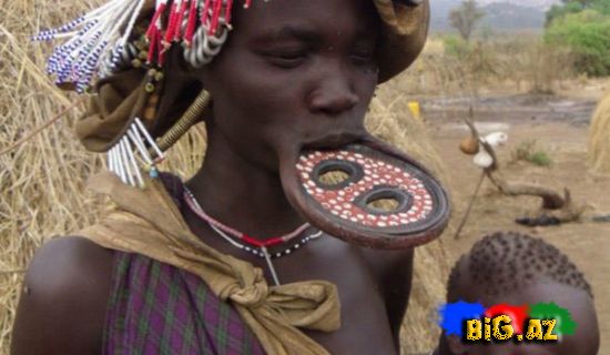 Dodaq böyütməyin iyrənc yolları - FOTO