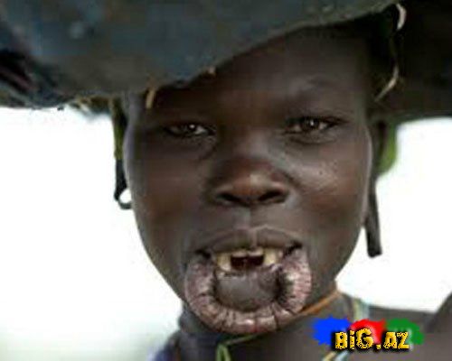 Dodaq böyütməyin iyrənc yolları - FOTO