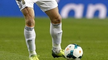 Məşhur futbolçunun ayağı protezdir? - FOTO