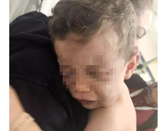 2 yaşlı körpə anasının sevgilisi tərəfindən döyülüb