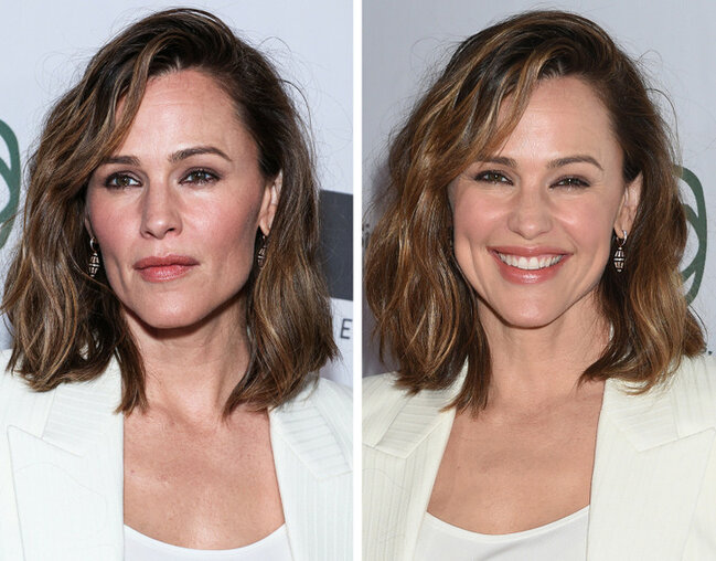 Təbəssüm etdikdə sanki başqa insana çevrilən 17 ULDUZ - FOTO