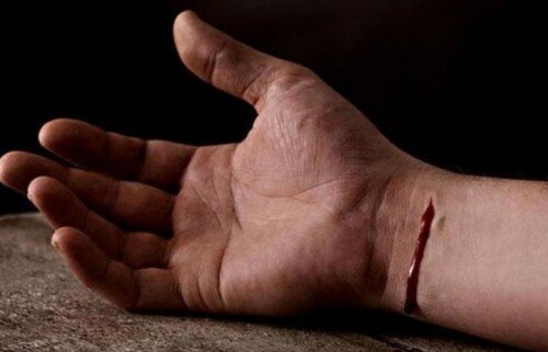 77 yaşlı kişi özünü doğradı