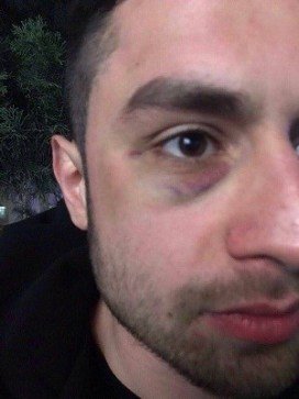 Qüdrət Şükürov döydürdüyü kürəkənini həbs etdirə bilmədi - özü həbsə gedir