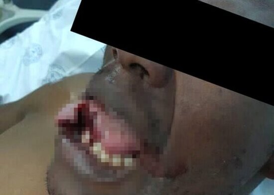 Qadın həkim ona təcavüz edən xəstənin dilini qopardı: DİŞİ İLƏ... (+18 FOTO)