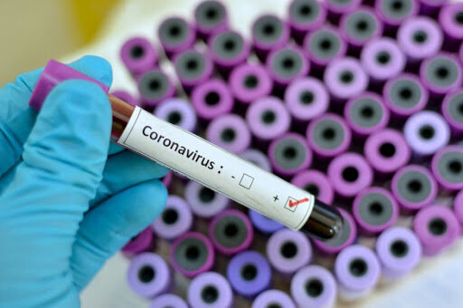 Məşhur aparıcının oğlu koronavirusdan öldü — FOTO