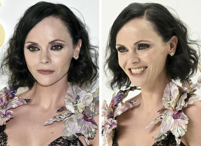 Təbəssüm etdikdə sanki başqa insana çevrilən 17 ULDUZ - FOTO