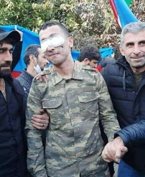 Vətən üçün İKİ GÖZÜNDƏN keçən ƏSGƏRİMİZ ÜRƏK DAĞLADI- FOTO