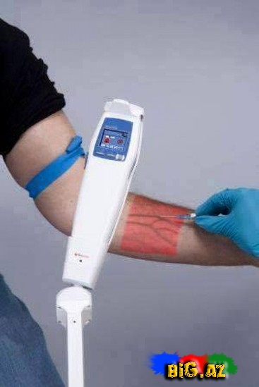 Bu cihazla damara iynə vurmaq asanlaşacaq - FOTO
