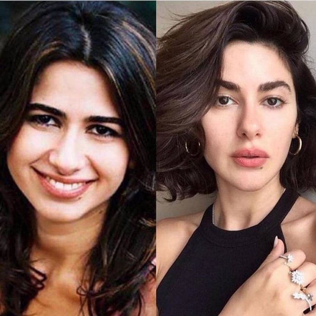 Nəsrinin arxiv fotosu bəyənilmədi: "Plastik əməliyyat etdirib"