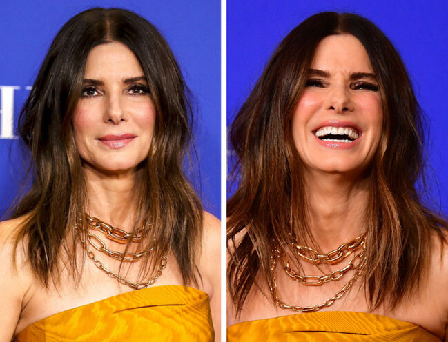 Təbəssüm etdikdə sanki başqa insana çevrilən 17 ULDUZ - FOTO