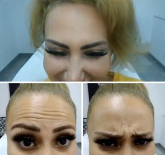 Həbsdən yeni çıxan Təranəni belə görməmişdiniz - FOTO