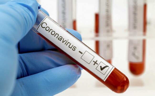 Gürcüstanda koronavirusa 2 061 yeni yoluxma qeydə alınıb, 23 nəfər ölüb